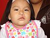 Leydith Ccoa Rodriquez (1 year old) before and after her operation in november 2009