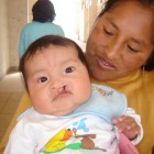 Already 80 children for our upcoming operation projects