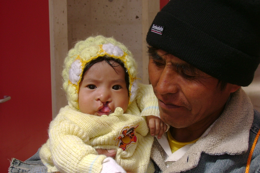 The story of Rosa (3 months old) from JuiliacaHet verhaal van Rosa (3 mnd. oud) uit Juiliaca